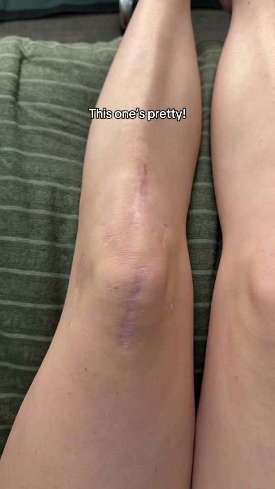 TikTok video thumbnail by rebekahbean